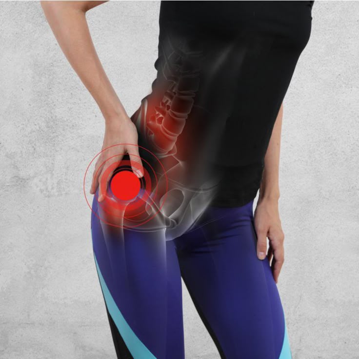 5 Hip Pain Relief Through Physical Therapy: Physical Therapy in NYU